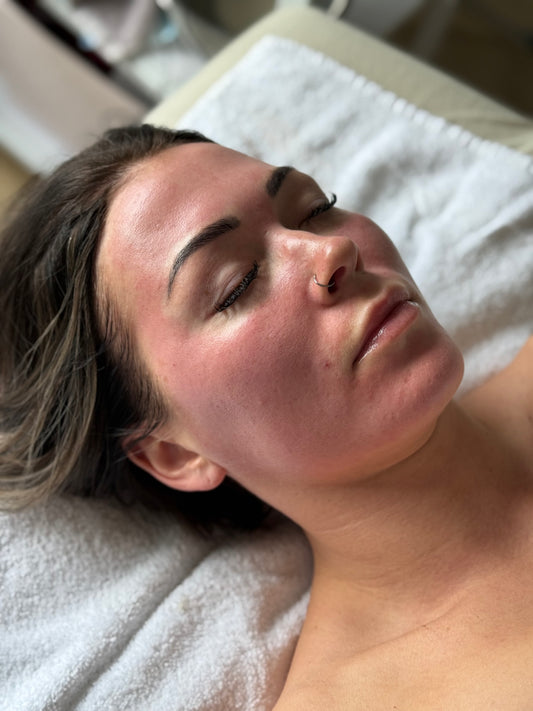 Micro-needling Package