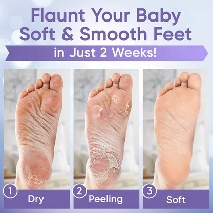 Exfoliation Foot Peel - Lavender