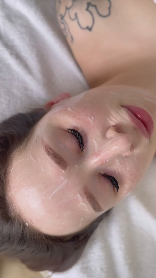 DAY 5 — Holiday Deal 20% OFF Microneedling